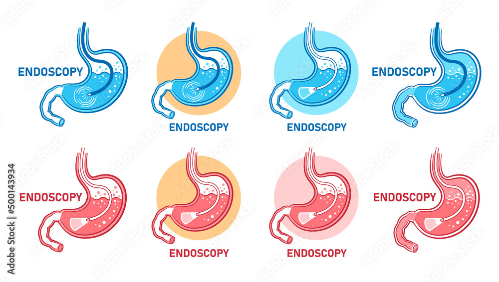 Endoscopy stomach, gastroscopy, gastrointestinal medical diagnostic