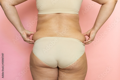 Fototapeta Woman with thick legs and buttocks closeup, pinch sagging folds on back, fat and cellulite