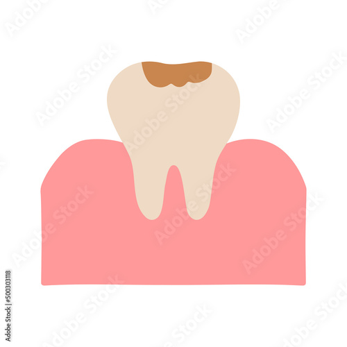 Cute cartoon tooth Feel bad. dental caries, toothache, bad teeth, limestone, swollen gums. diseased tooth and oral cavity. on blue background.