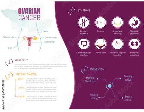 Infographic of ovarian cancer, q, types, symptoms and how to prevent it and its corresponding icons. photo