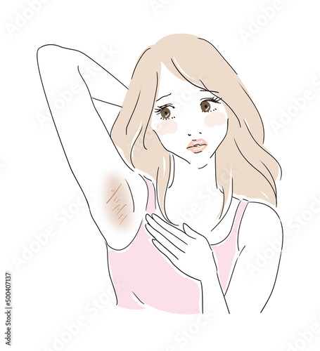 脇の下の肌の黒ずみが気になり悩む女性
