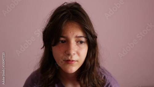 Video of an apathetic and desmotic adolescent, a girl with acne, in her room rests her head on her hand in a gesture of tiredness