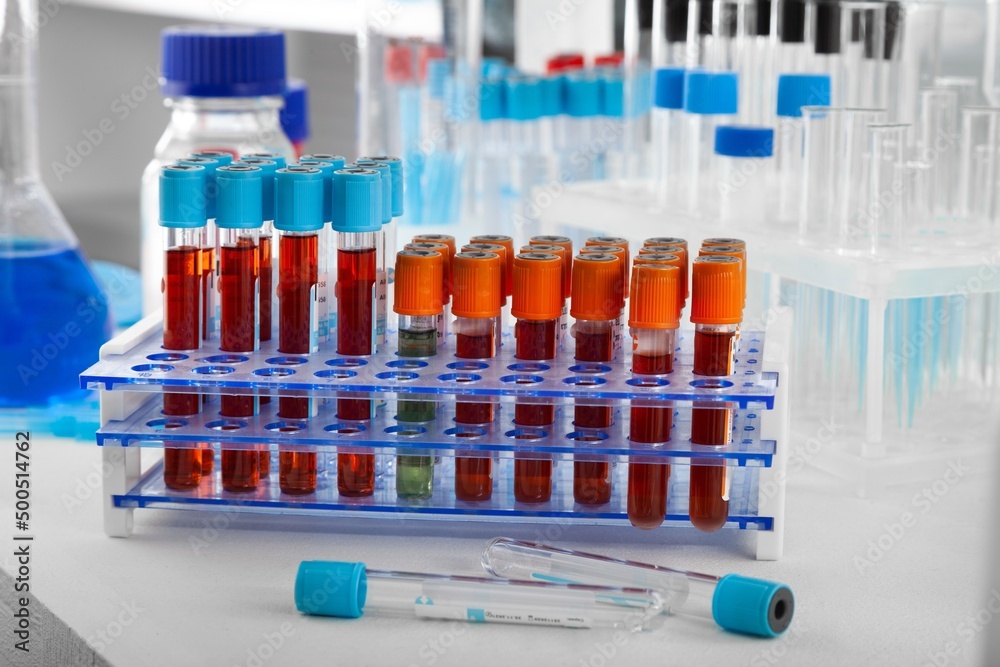 Analysis lab sample of new strain of Coronavirus Omicron. Analysis lab sample of new strain of Coronavirus Omicron.
