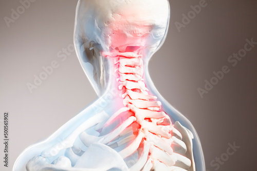 Canvas Neck pain, upper spine, cervical vertebrae spine, human body anatomy