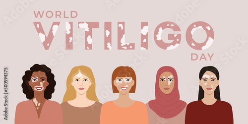 World vitiligo day June 25 banner. Female faces with different ethnics, skin colors, hairstyles with vitiligo skin disease. Body positive concept. Flat vector illustration photo