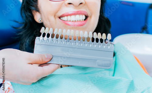 Cosmetological teeth whitening in a dental clinic, selection of the tone of the implant tooth, Woman Holding Set Of Implants With Various Shades Of Tone, Smiling young woman.
