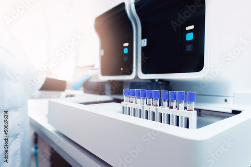 Fotografía Medical robot machine for biochemical automatic testing blood laboratories