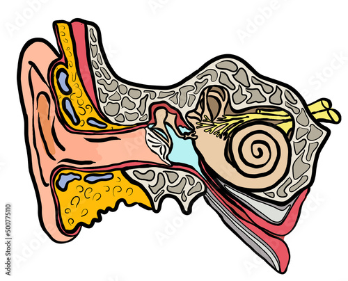Canvastavla anatomische Sicht auf ein Ohr mit Paukenerguss hinter dem Trommelfell