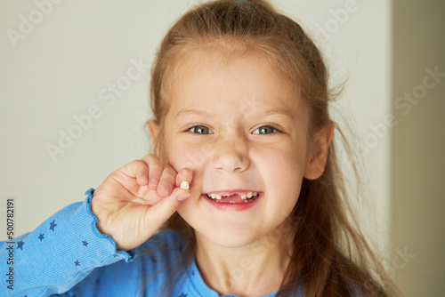 Toothless child. Cute little girl smiles broadly. The first milk tooth fell out. The concept of pediatric dentistry and dental hygiene