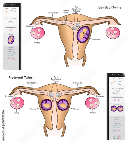 Human Twins Infographic Diagram types identical fraternal comparison chart egg sperm fertilization zygote placenta monozygotic dizygotic placentation genetic science education gene biology vector