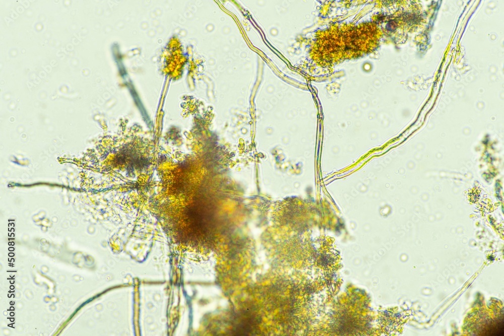 biological organisms under the microscopes in australia. living ...