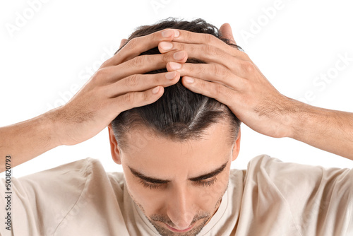 Handsome brunette man with hair loss problem on white background, closeup