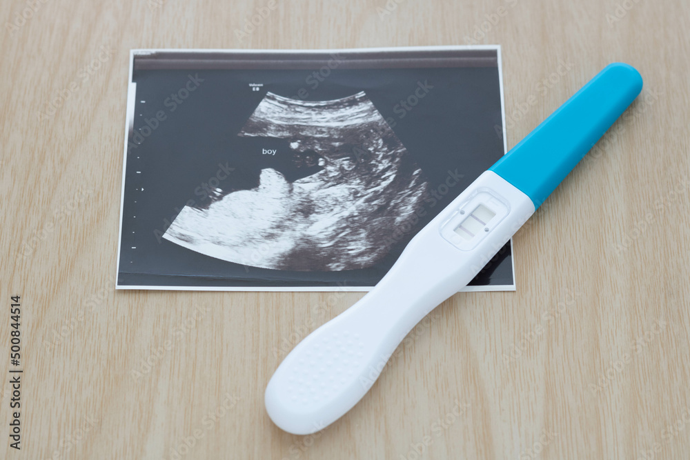 Pregnancy test showing a positive result and ultrasound picture of baby
