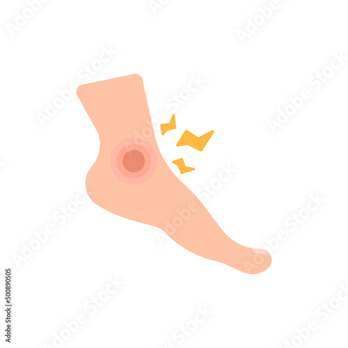 pain in the ankles. disease, injury, joint pain. health problems. flat cartoon illustration. design elements. human body parts