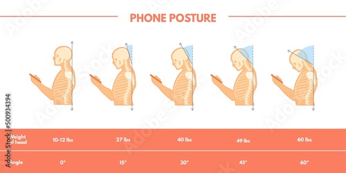 Care neck posture. Spine pain position with phone, correct standing head for anatomy health painful moving bone back muscle, mobile addiction, danger angle human necks, neat vector