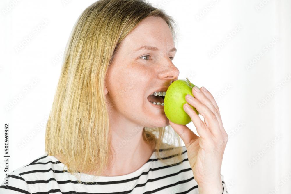 Young woman with dental braces biting green apple isolated light background. Studio. Cute lovely girl with metal braces on white clear teeth smiling in clinic. Close Up. Positive Emotion. Stomatology Young woman with dental braces biting green apple isolated light background. Studio. Cute lovely girl with metal braces on white clear teeth smiling in clinic. Close Up. Positive Emotion. Stomatology