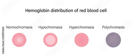 Red blood cell morphology. Hemoglobin distribution of red blood cell.