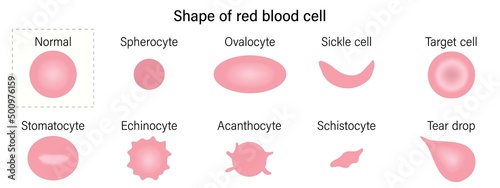 Red blood cell morphology. Shape of red blood cell. Spherocyte, Ovalocyte, Sickle cell, Target cell, Stomatocyte, Echinocyte, Acanthocyte, Schistocyte and Tear drop. photo