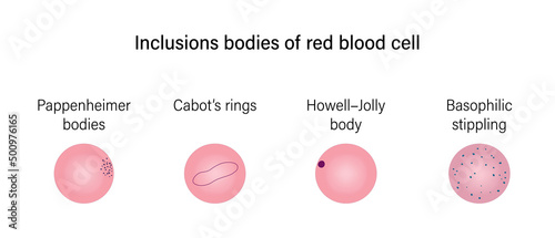 Red blood cell morphology. Inclusions bodies of red blood cell.