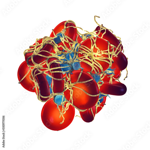 Activated platelets (thrombocytes) forming a blood clot (thrombus) covered by fibrin mesh. The platelets are blood cells responsible for repairing blood vessel damage. Blood clot isolated on white photo