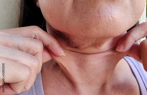 Portrait showing the fingers squeezing flabbiness adipose hanging under the neck, problem wrinkles and flabby skin under the chin, concept health.