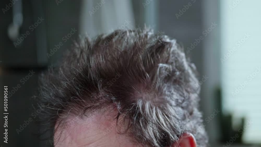 The man is drying his crazy hair, thinning hair. Slow motion video. The man is drying his crazy hair, thinning hair. Slow motion video.