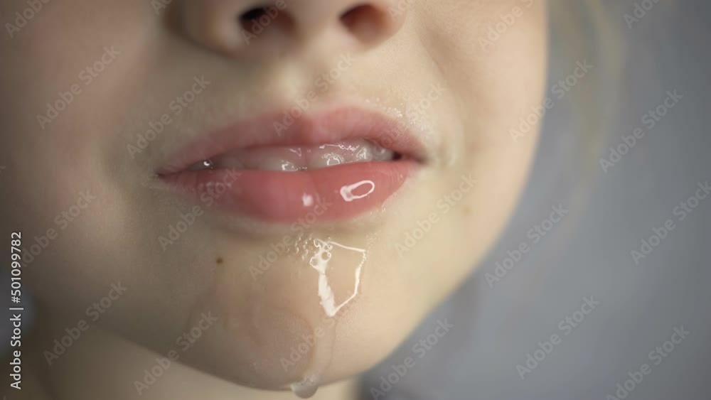 kid salivation girl opens her mouth child shows his teeth soft palate and mouth to dentist. mouth is wide open, tongue is stuck out as far as possible, with clear view of tongue Stock ビデオ | Adobe Stock 
