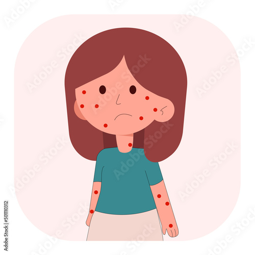 Little girl baby kids face sick chickenpox virus infographics icon design. Vector flat character illustration. Looking reach of children which has symptoms of smallpox chickenpox.