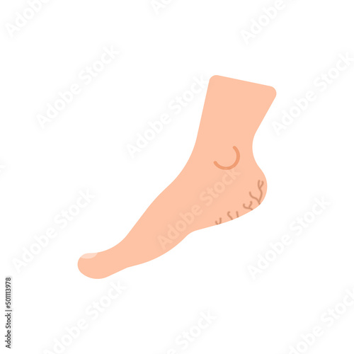 pain in the ankles. disease, injury, joint pain. health problems. flat cartoon illustration. design elements. human body parts