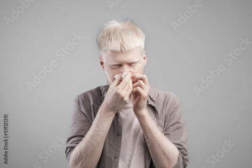 Portrait of young albino man blowing his nose and wiping nose with napkin over gray wall background