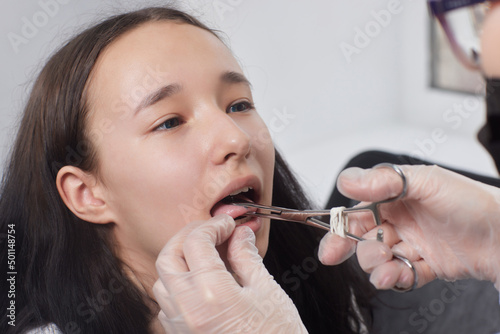 Tongue piercing operation Professional holding the jewel. photo