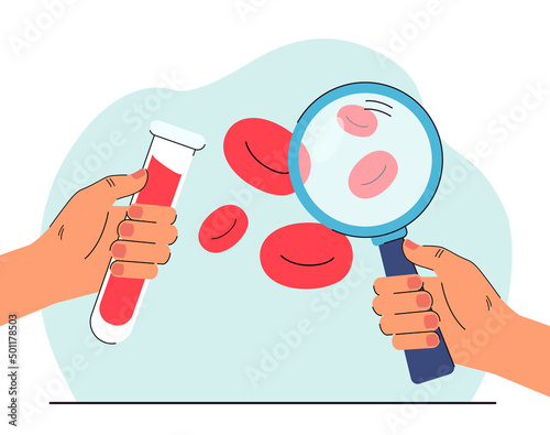 Hands holding magnifying glass and tube with blood sample. Doctor examining red blood cells of patient flat vector illustration. Medicine, health concept for banner, website design or landing web page