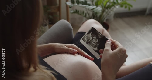 Relaxing pregnant woman holds ultrasound picture of her baby. The expectant loving mother caresses her baby in the tummy. Belly of a pregnant woman. Maternity prenatal care and pregnancy concept.