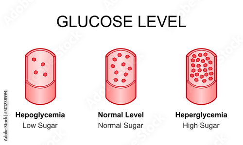 Scientific Designing of Blood Sugar Comparaison in Human Capillary. Blood Glucose Level. Hypoglycemia and Hyperglycemia Colorful Symbols. Vector Illustration. photo