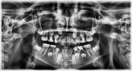 Panoramic x-ray image of teeth