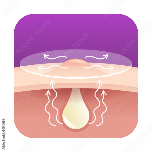 Acne pimple patch square icon