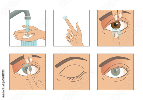 Contact lenses. Instruction how to put on lenses. 5 steps. Wash your hands, take a lens, check the position of the lens. Carefully insert the lens