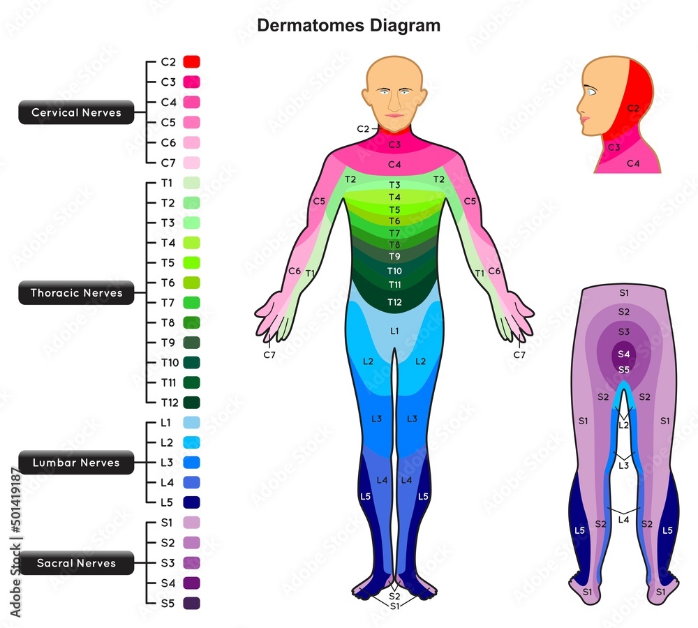 Dermatomes Diagram Infographic Nerves Areas Of Human Body From Spinal 