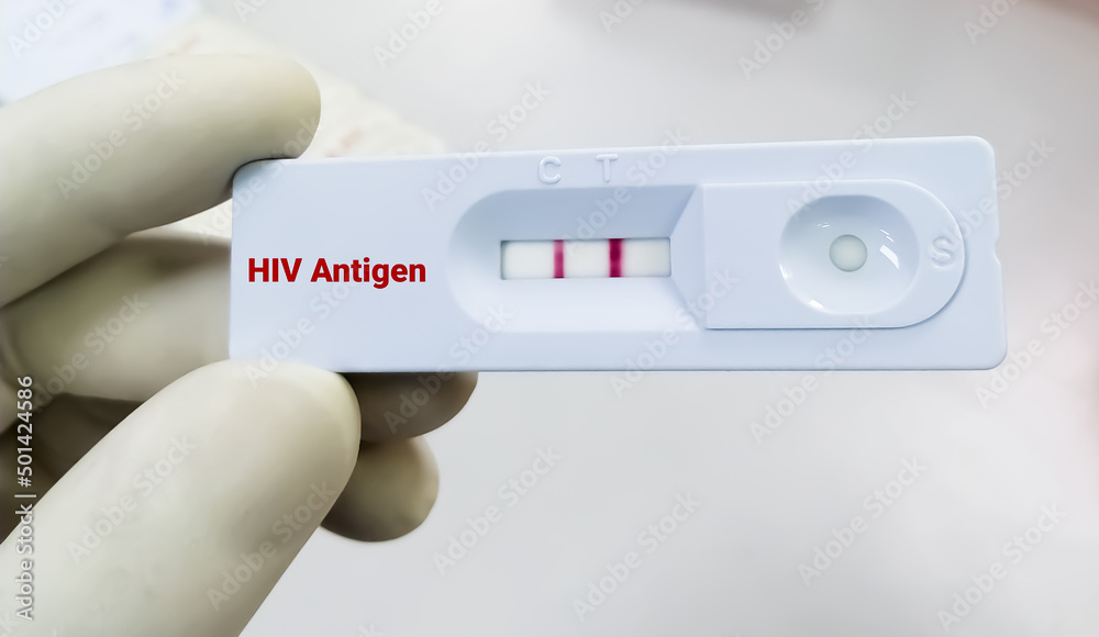 Rapid test cassette for HIV antigen, AIDS - obrazy, fototapety, plakaty 