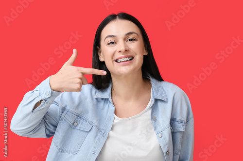 Beautiful woman pointing at dental braces on red background photo