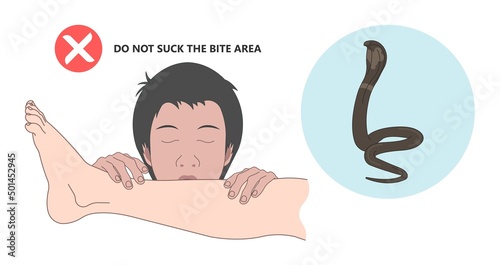 Snake Bite First Aid care non venomous anti venom serum hand leg king cobra treat kit death injury help safe call pain blood healing prevent coral fangs step poster grabbing splint limb sign tongs