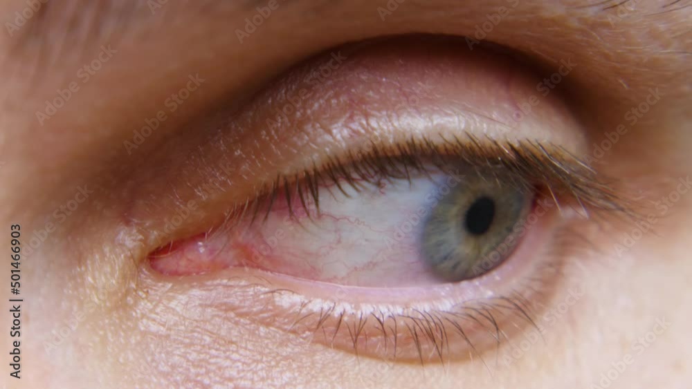 A macrosection of the male eye. The blue iris is surrounded by numerous red capillaries. An eyelid with eyelashes blinks several times. The eye is looking in different directions A macrosection of the male eye. The blue iris is surrounded by numerous red capillaries. An eyelid with eyelashes blinks several times. The eye is looking in different directions