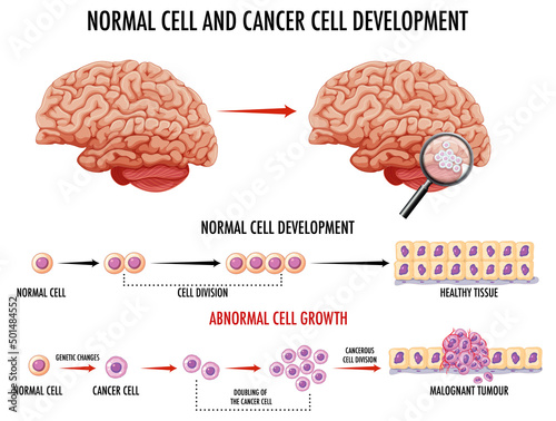 Diagram showing normal and cancer cells in human
