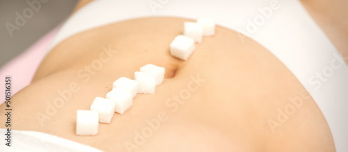 The concept of epilation, waxing. Sugar cubes lying in a row on the abdomen of a young white woman, close up © okskukuruza