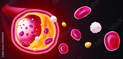 3D Illustration of red blood cells, white blood cells and cholesterol clogging the cause of death. medical use science, education