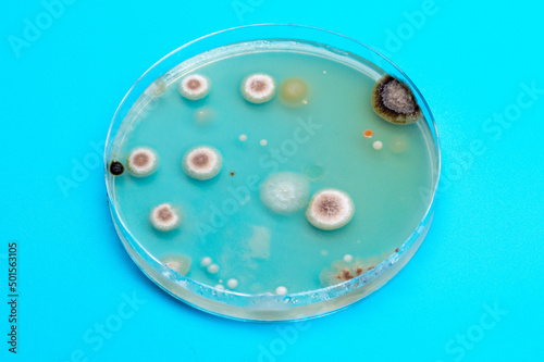 Petri dish with biological samples in a laboratory of a medical clinic