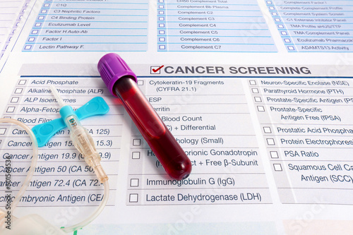 Blood test sample for Tumor markers test for diagnosis cancer. Blood analysis with request form for screening of test for Malignancy oncology cancer cells investigation in patient photo