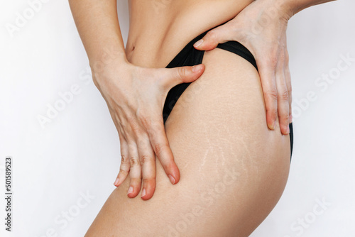 Cropped shot of a young woman in black panties with white stretch marks from a weight loss or weight gain on her thigh isolated on a white background. Changes in the body. Cosmetology, beauty concept