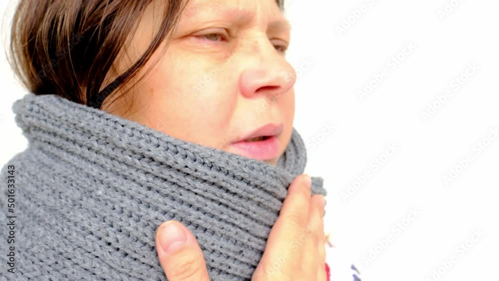 closeup of mature woman 55 years face, sick person with inflamed eyes