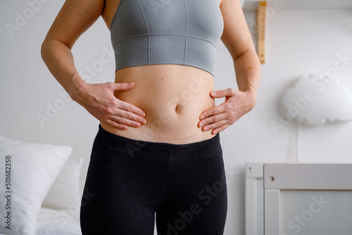 Close up of a belly with scar from c-section. Women’s health. A woman dressed up in sportswear demonstrating her imperfect body after a childbirth with nursery on the background. photo